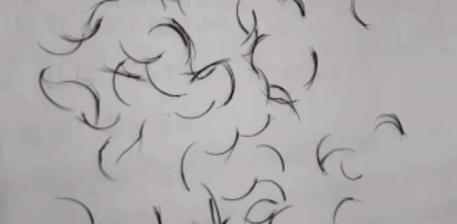 女子眼角掉出74根眼睫毛